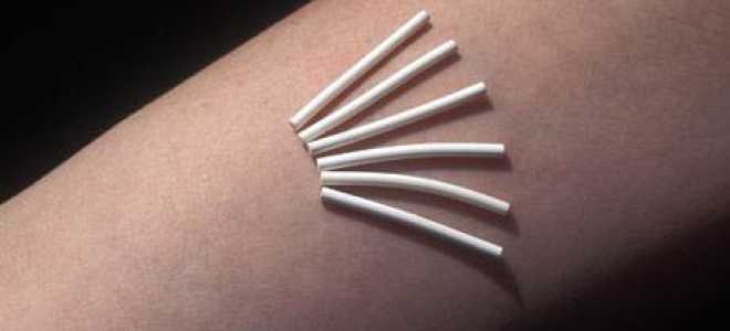 Что нужно делать, чтобы забеременеть. несколько советов